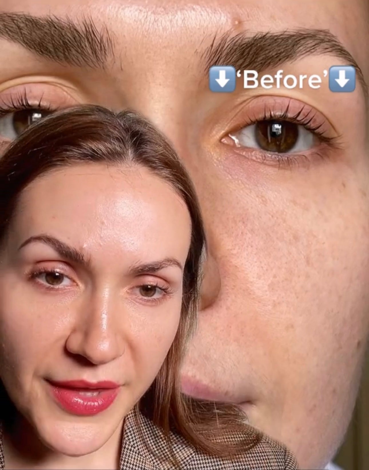 Decoding the Origins of Dark Spots on the Face