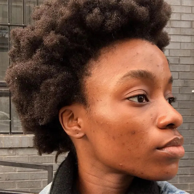 Delicate Beauty Revealed: Unlocking The Secrets Of Skin Sensitivity and Nurturing Radiant Complexions