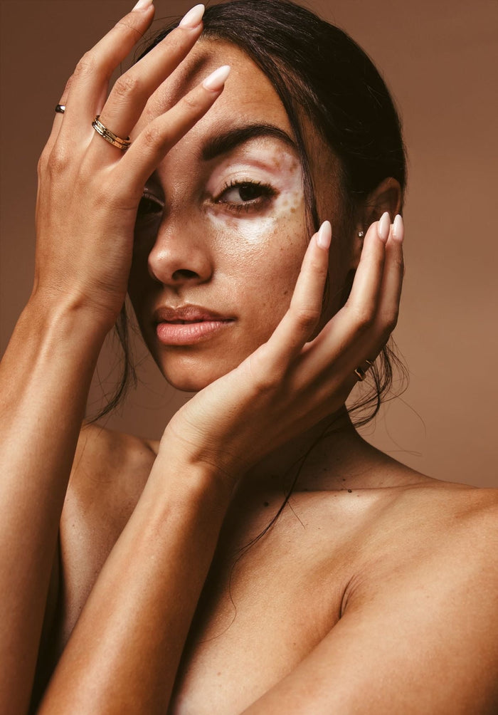 Unravelling the Mystery: Understanding Why Hyperpigmentation Happens