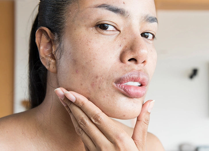 Cracking the Code: The Hidden Culprits Behind Dry Skin Unveiled!